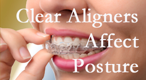 Clear aligners influence posture which Concord, NC chiropractic helps.