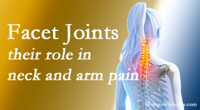 Pure Chiropractic thoroughly examines, diagnoses, and treats cervical spine facet joints for neck pain relief when they are involved.