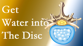 Pure Chiropractic uses spinal manipulation and exercise to boost the diffusion of water into the disc which helps the health of the disc.