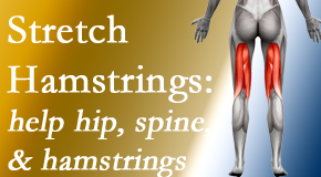 Pure Chiropractic encourages back pain patients to stretch hamstrings for length, range of motion and flexibility to support the spine.