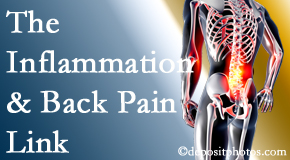 Pure Chiropractic tackles the inflammatory process that accompanies back pain as well as the pain itself.