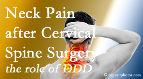 Pure Chiropractic offers gentle treatment for neck pain after neck surgery.