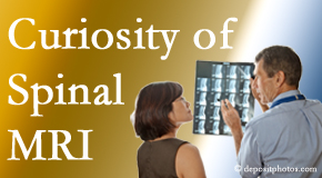 Concord, NC MRIs for spinal stenosis may be revealing…or puzzling.