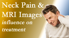 Pure Chiropractic takes into consideration MRI findings like Modic Changes when setting up a neck pain relieving treatment plan.