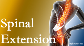 Pure Chiropractic knows the role of extension in spinal motion, its necessity, its benefits and potential harmful effects. 