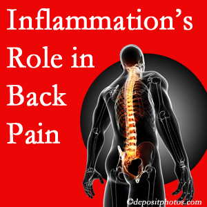 The role of inflammation in Concord, NC back pain is real. Chiropractic care can manage it.