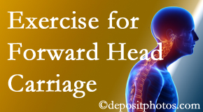 Concord, NC chiropractic treatment of forward head carriage is two-fold: manipulation and exercise.