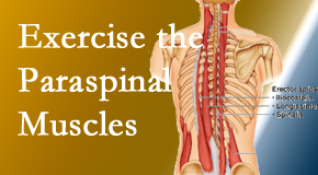 Pure Chiropractic explains the importance of paraspinal muscles and their strength for Concord, NC back pain relief.