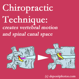 image of a tight spinal canal area