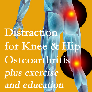 A chiropractic treatment plan for Concord, NC knee pain and hip pain caused by osteoarthritis: education, exercise, distraction.