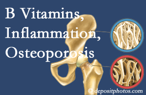 Concord, NC chiropractic care of osteoporosis usually comes with nutritional tips like b vitamins for inflammation reduction and for prevention.