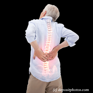 image Concord, NC back pain with lumbar spinal stenosis