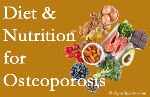 Concord, NC osteoporosis prevention tips from your chiropractor include improved diet and nutrition and reduced sodium, bad fats, and sugar intake. 