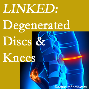 Degenerated discs and degenerated knees are not such strange bedfellows. They are seen to be related. Concord, NC patients with a loss of disc height due to disc degeneration often also have knee pain related to degeneration. 