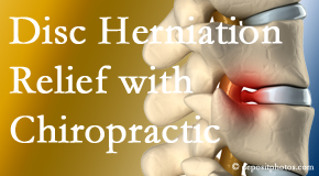 Pure Chiropractic gently treats the disc herniation causing back pain. 